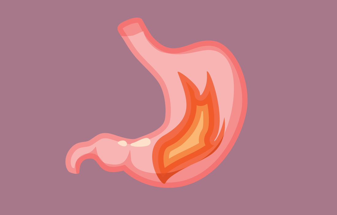 Brûlures intestinales : que faire pour les soulager efficacement ?